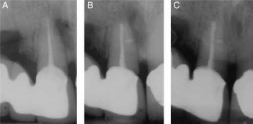 Periodontal status