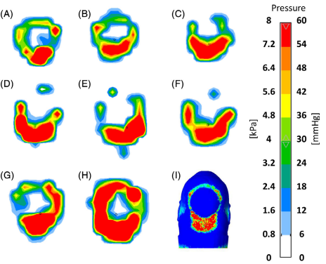 Pressure Regions on the back headÂ